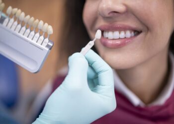 كل ما تحتاج إلى معرفته حول الكسوة الخزفية للأسنان