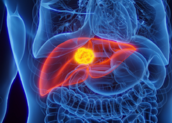 تعديل في النظام الغذائي قد يوقف نمو سرطان الكبد