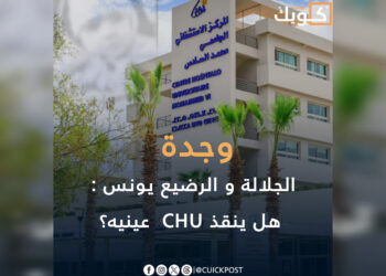 الجلالة و الرضيع “يونس”: هل ينقذ CHU عينيه؟