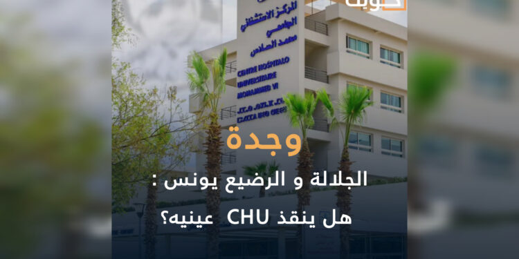 الجلالة و الرضيع “يونس”: هل ينقذ CHU عينيه؟