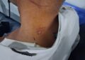 بين الواجب والخطر.. سلك متدلٍ يكاد ينهي مهمة شرطي بوجدة
