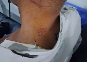 بين الواجب والخطر.. سلك متدلٍ يكاد ينهي مهمة شرطي بوجدة