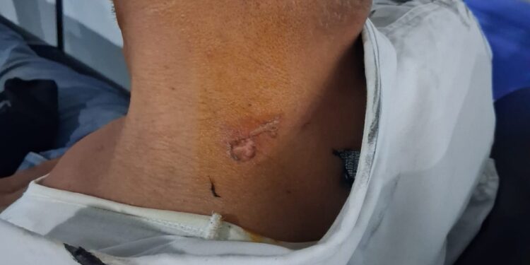بين الواجب والخطر.. سلك متدلٍ يكاد ينهي مهمة شرطي بوجدة
